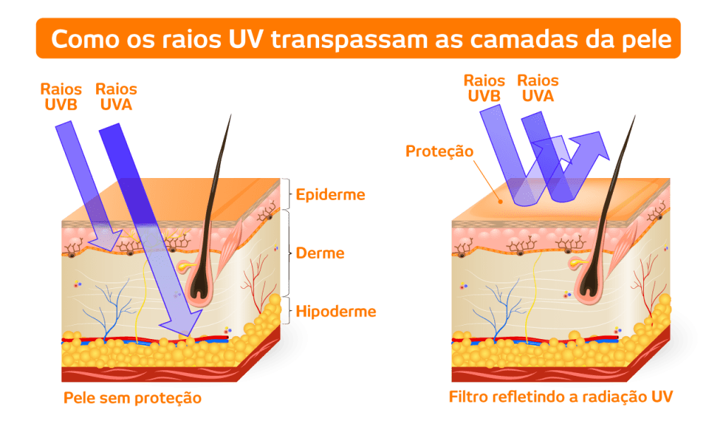 Gráfico mostrando a penetração dos Raios Ultra Violetas na pele sem proteção e com filtro refletindo a radiação.